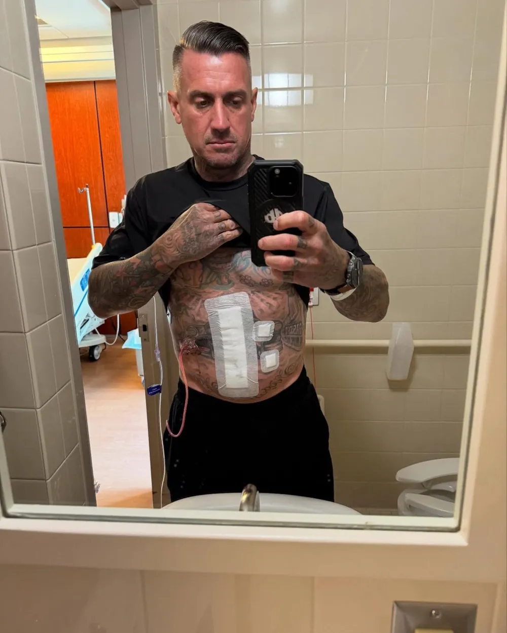 Carey Hart Injury 1.jpg