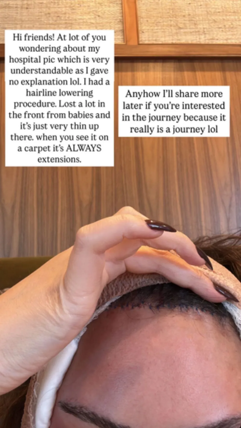 Chrissy Teigen Shares Explanation About Her Mystery Procedure