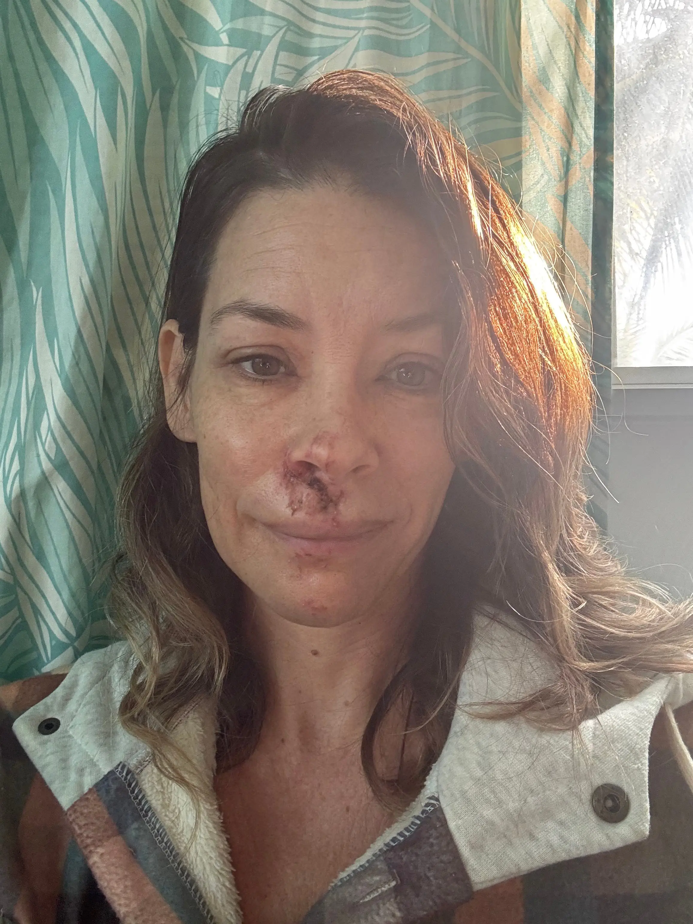 Evangeline Lilly Fainted and Fell Face-First Into Boulder at the Beach