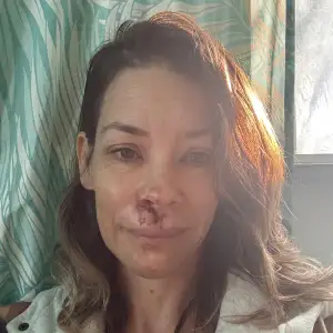Evangeline Lilly Fainted and Fell Face-First Into Boulder at the Beach