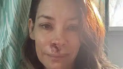Evangeline Lilly Fainted and Fell Face-First Into Boulder at the Beach