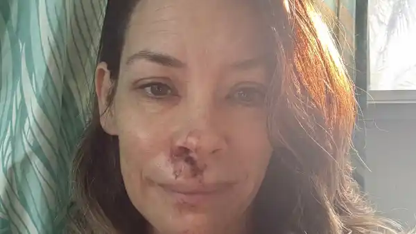 Evangeline Lilly Fainted and Fell Face-First Into Boulder at the Beach