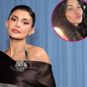 Kylie Jenner Goes Au Naturel in Pimple Selfie