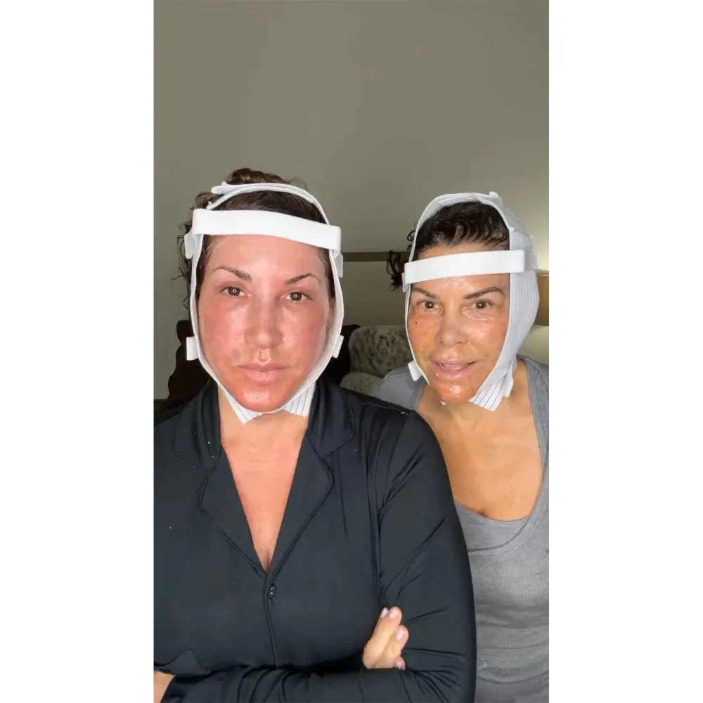 Real Housewives Jacqueline Laurita and Lynne Curtin Document Their Face Lifts Together