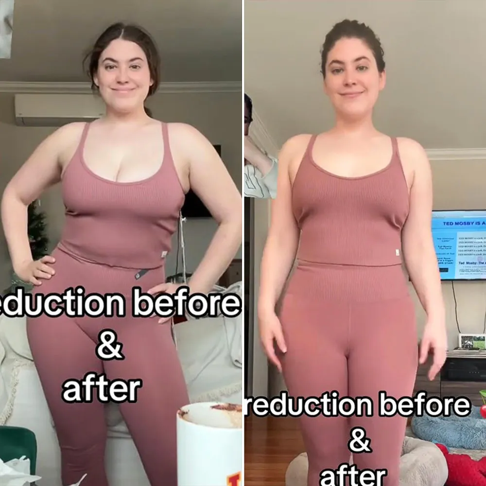 SI Swimsuit Model Gigi Robinson Says Breast Reduction Helped Her Chronic Illness TikTok