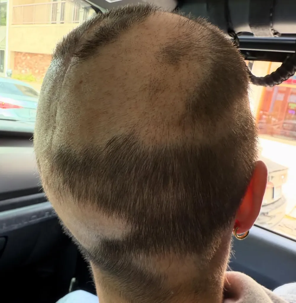 Teddi Mellencamp Shares an Emotional Hair Update Amid Cancer Battle