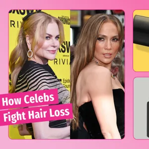 Celebrities' hair loss solutions