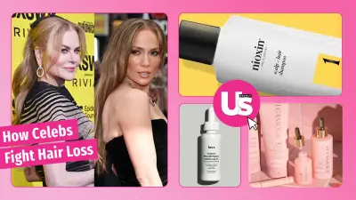 Celebrities' hair loss solutions