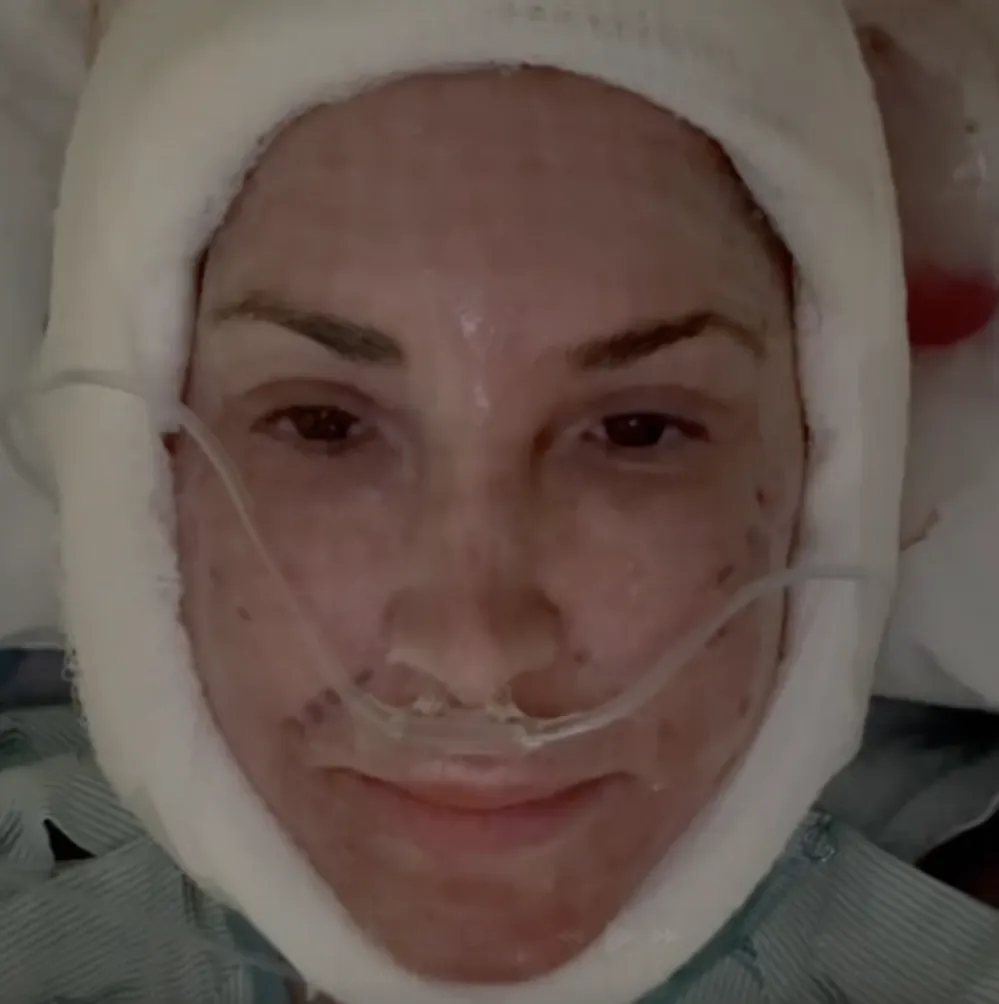 Jacqueline Laurita facelift