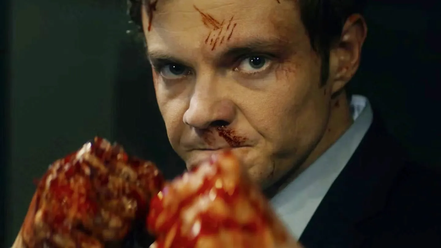 A man balls up his fists in 'Novocaine.'