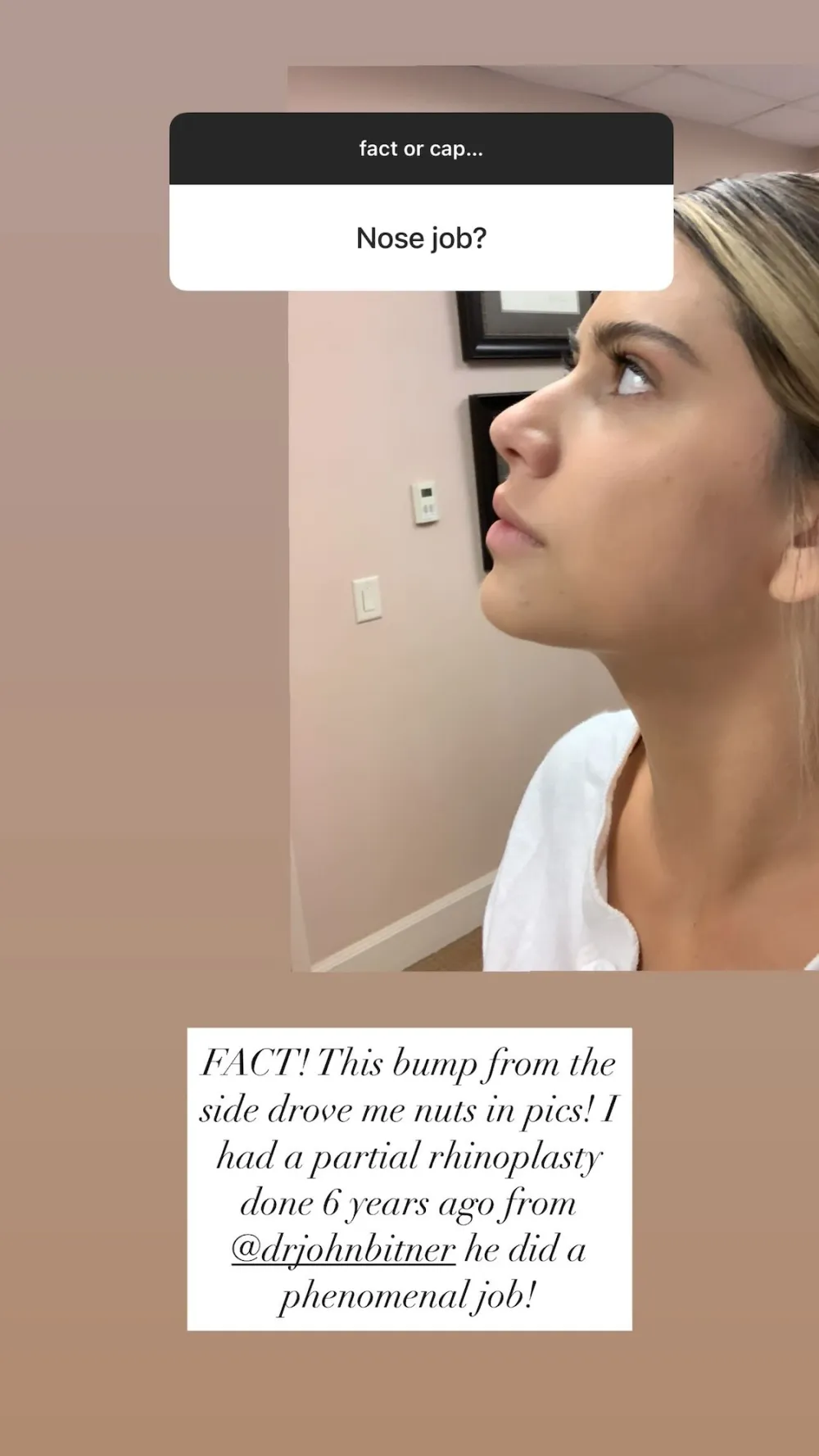 Demi Engemann Opens Up About Her Nose Job: &lsquo;This Bump Drove Me Nuts&rsquo;