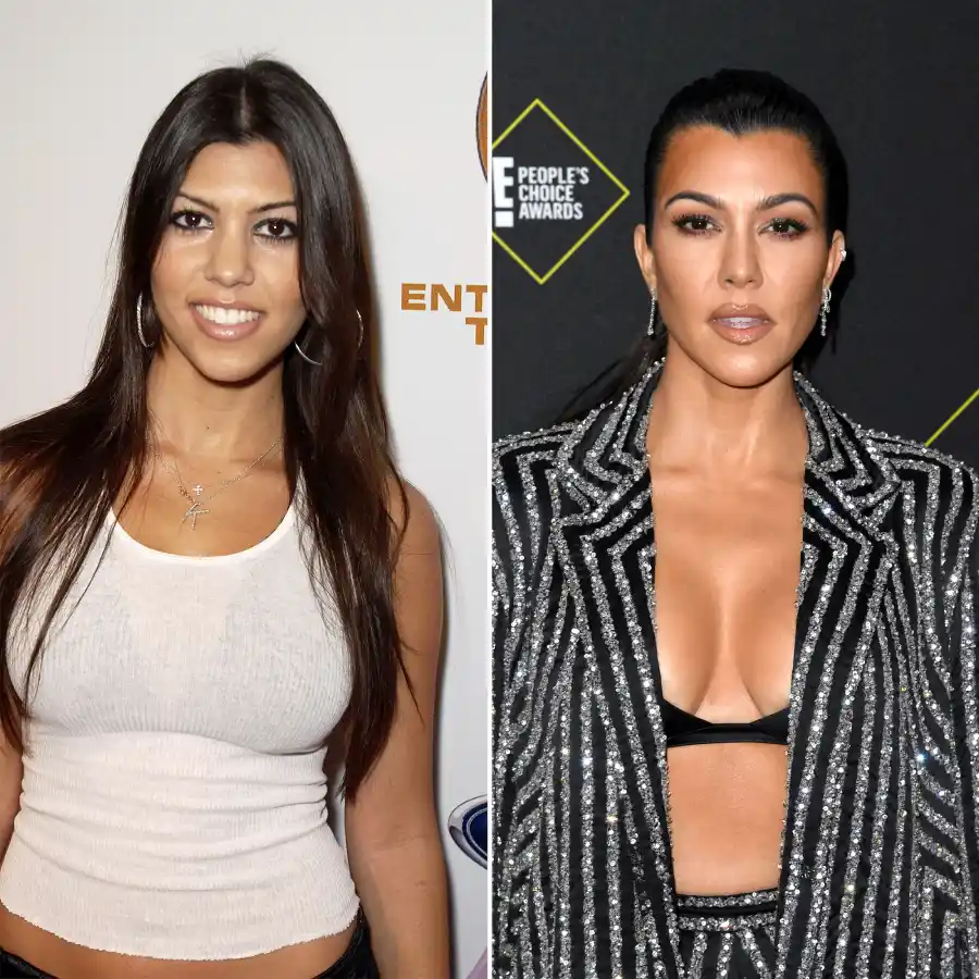 Every Time the Kardashians Revealed Their Surgery
