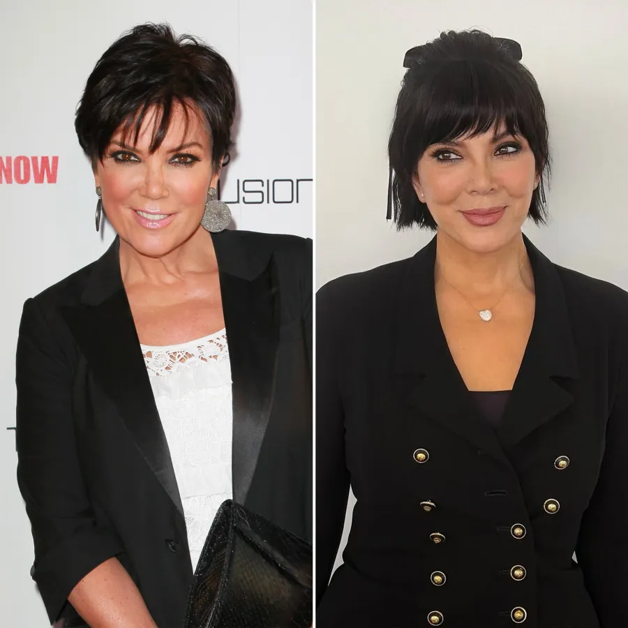 Every Time the Kardashians Revealed Their Surgery