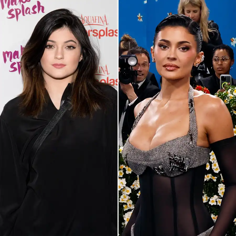 Every Time the Kardashians Revealed Their Surgery