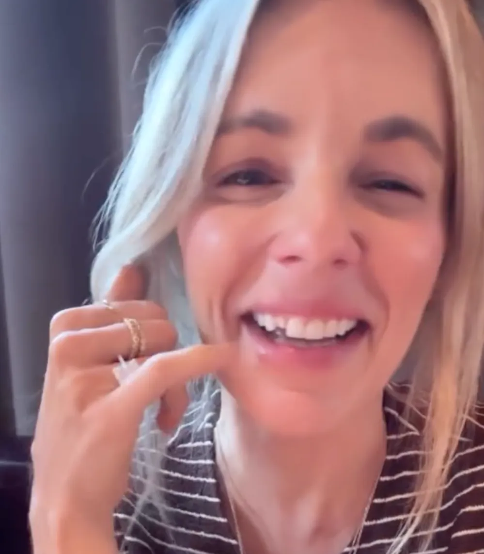 Former-Bachelorette-Ali-Fedotowsky-Loses-a-Tooth-at-Dinner-and-Swallowed-It-2