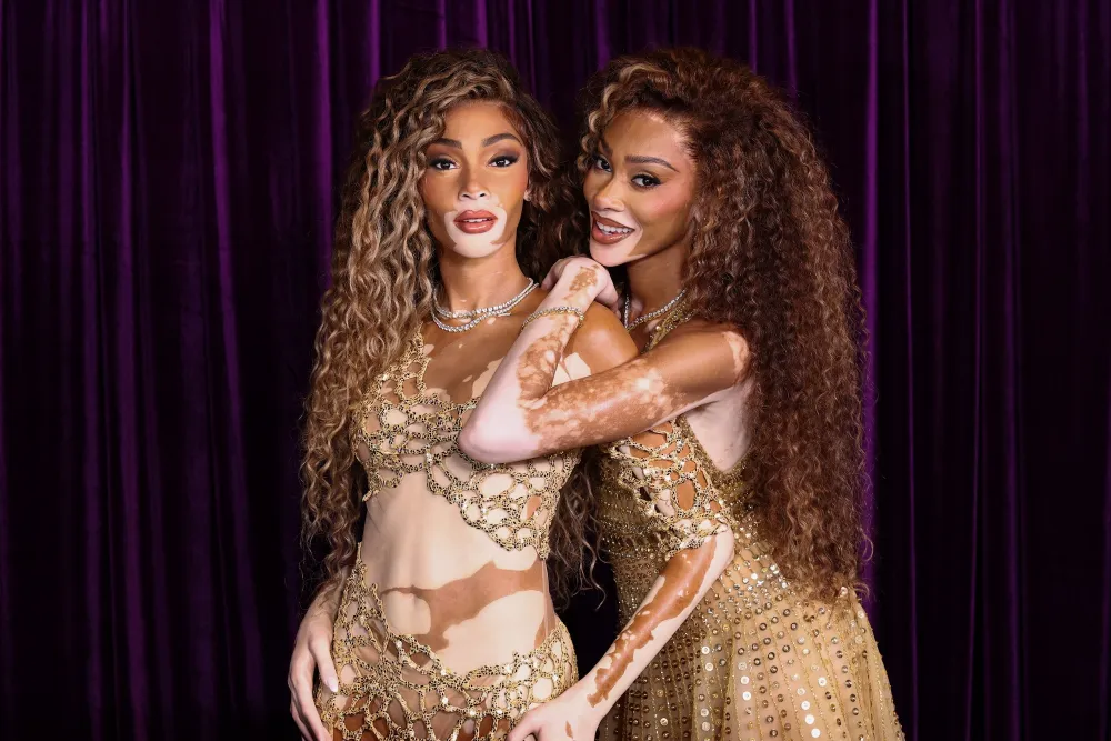 Winnie Harlow Wax Figure Launch at Madame Tussauds New York