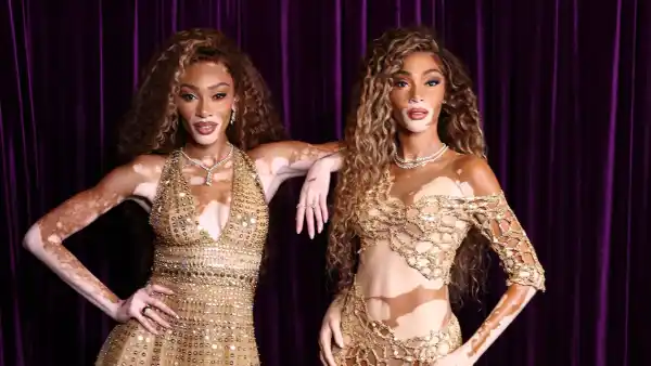Winnie Harlow Wax Figure Launch at Madame Tussauds New York