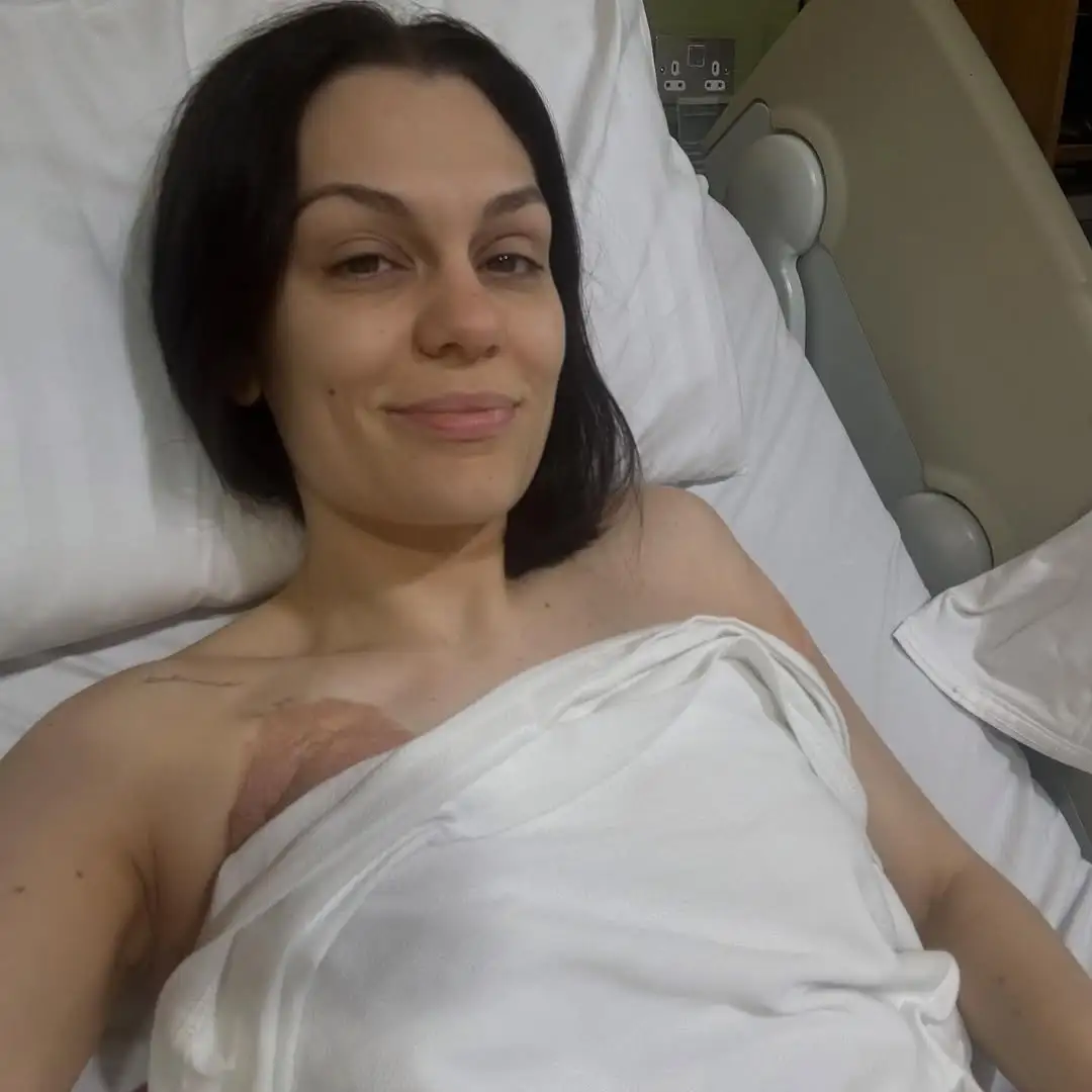 Jessie J Undergoes Breast Cancer Surgery