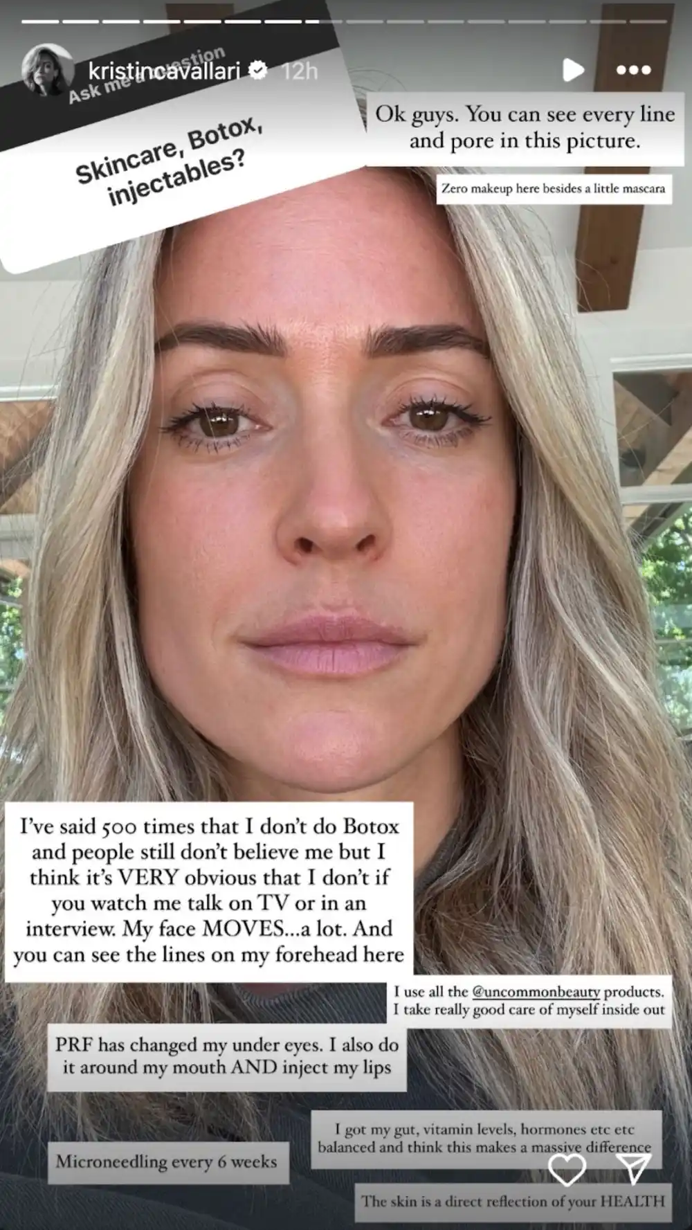 Kristin Cavallari Denies Ever Having Botox