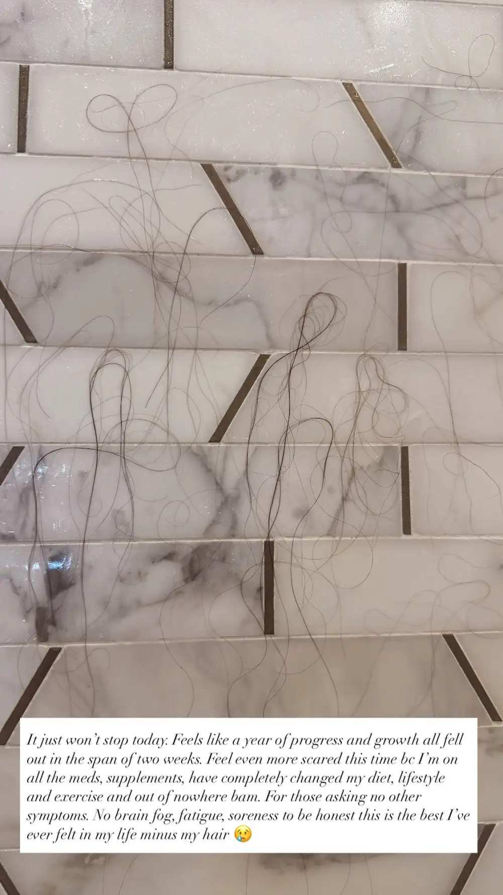 Samantha-Busch-Hair-Loss-Update