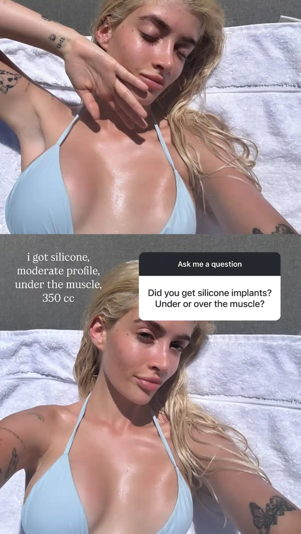 Sami Sheen Reveals Her Exact Breast Augmentation Details 1 Day After Kylie Jenner