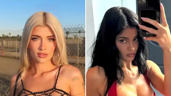 Sami Sheen Reveals Her Exact Breast Augmentation Details 1 Day After Kylie Jenner