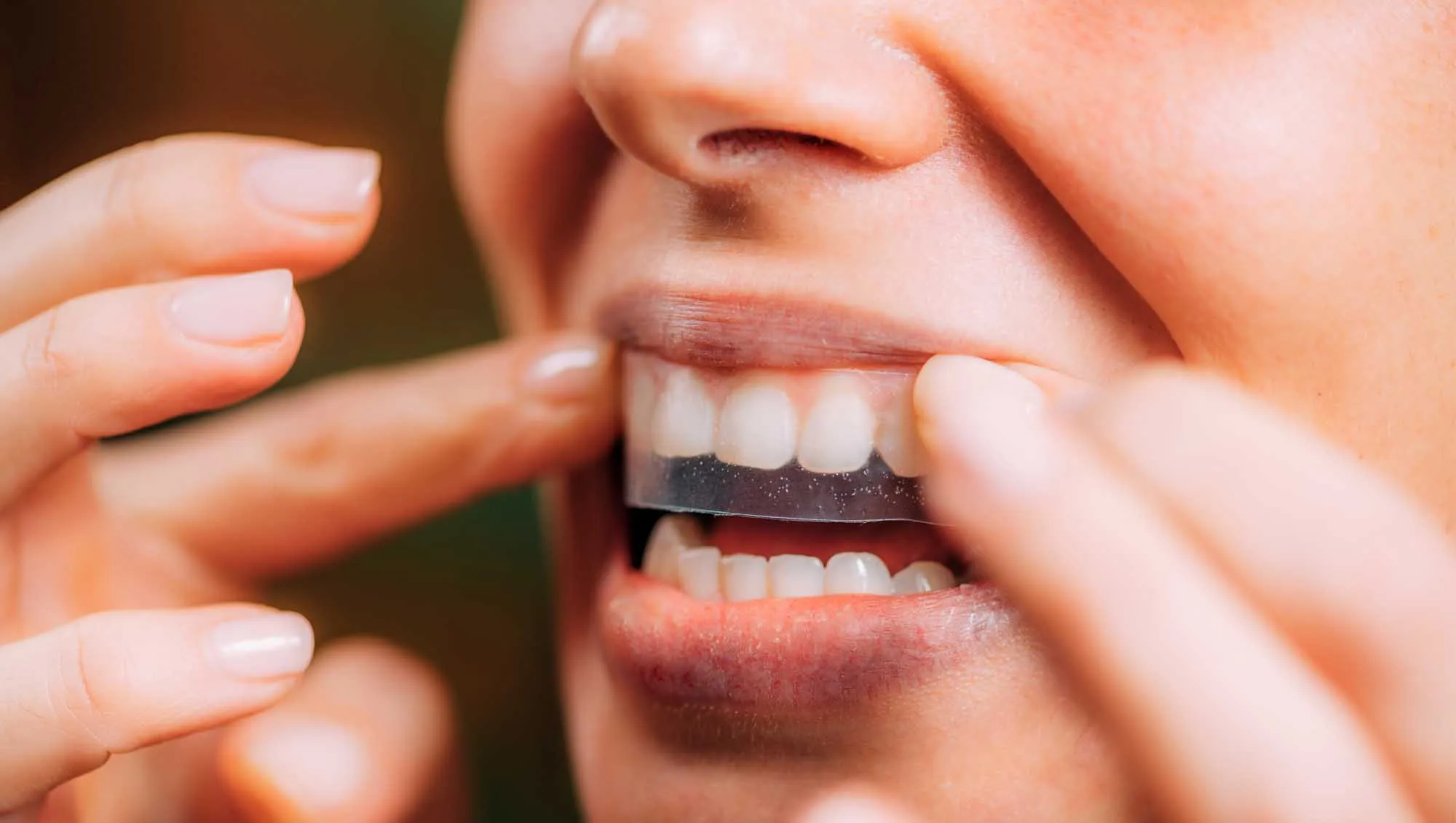 Teeth Whitening Strips