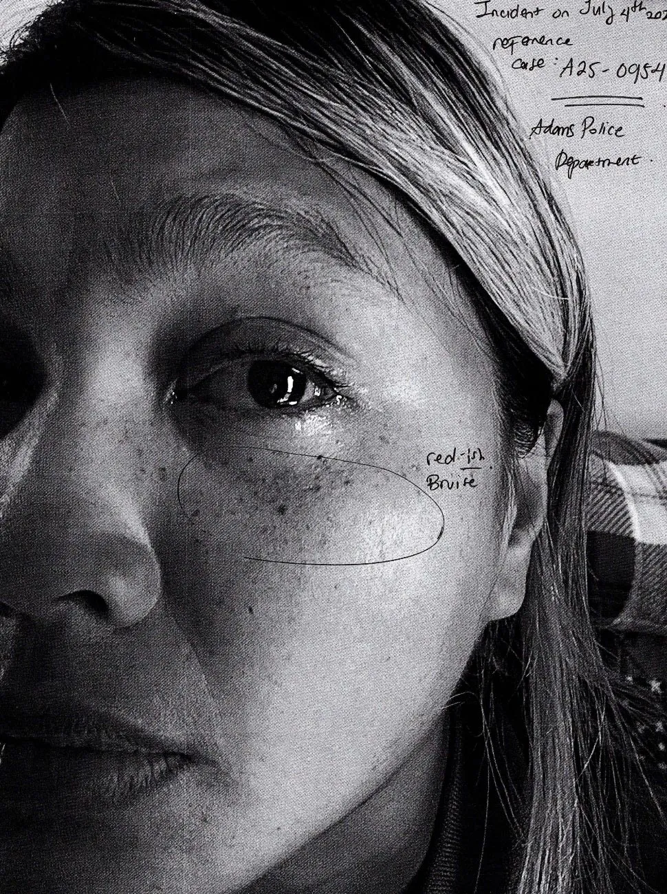 90 Day Fiance s Eric Rosenbrook s Wife Leida Pleads For Restraining Order Shows Alleged Injuries 002