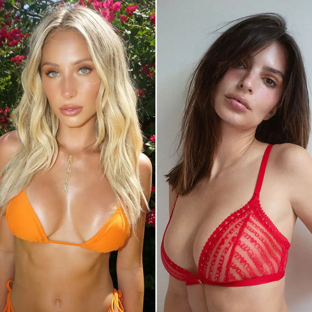 Alix Earle and Emily Ratajkowski Most Requested Celebrity Plastic Surgeries