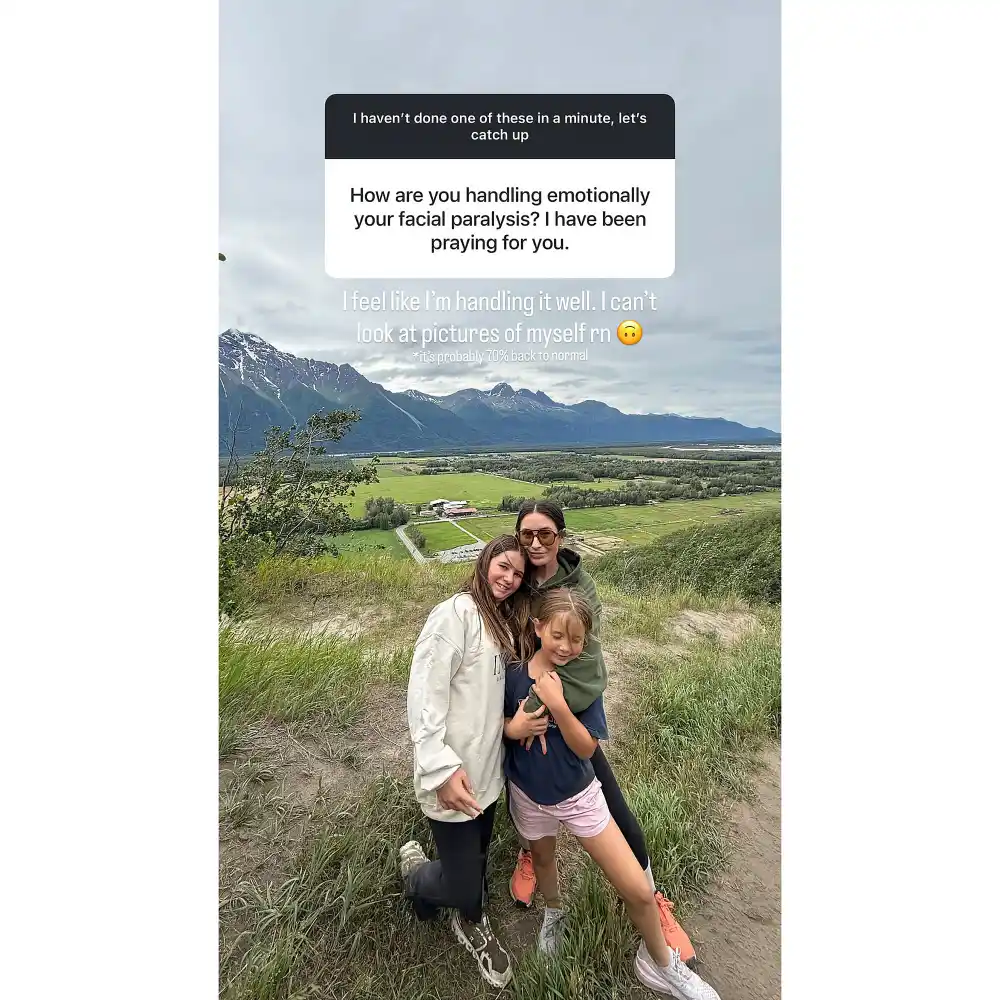 Bristol Palin Says Her Face Is 70 Percent Back to Normal After Paralysis