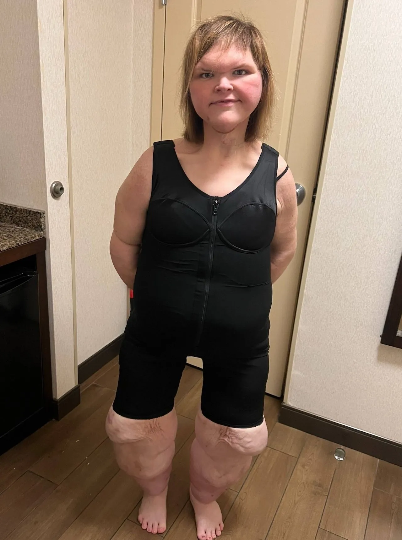 Tammy Slaton Wears Shapewear After Weight Loss Skin Removal Surgeries