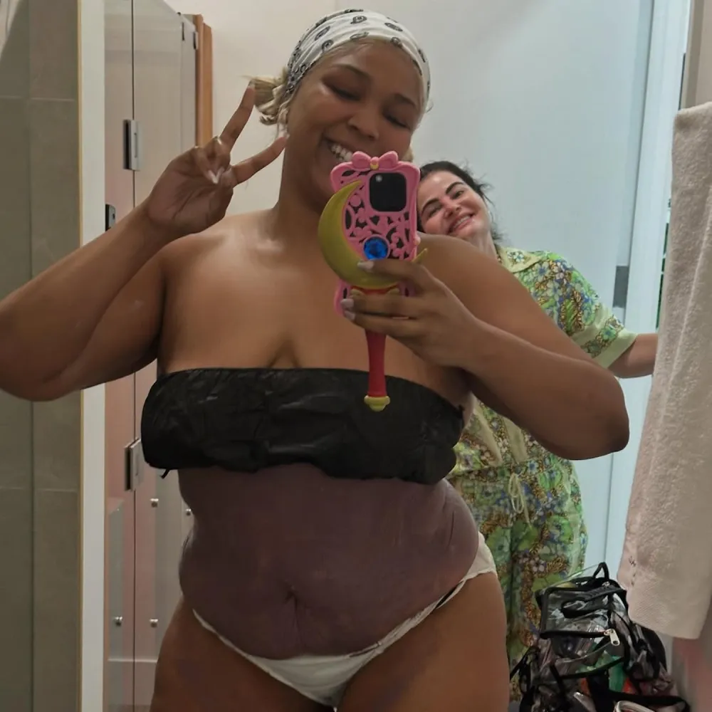 Lizzo Shares Truth About Weight Loss Alongside Before and After Photos 3
