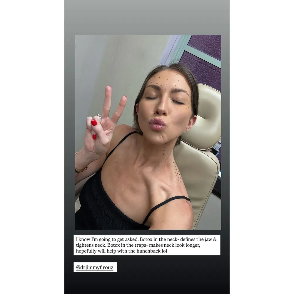 Stassi Schroeder Opens Up About Where She Gets Botox and Why 2