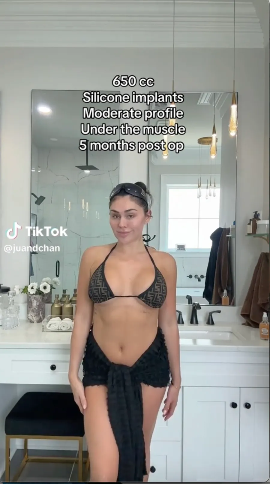 15 Stars Who Have Shared Exact Details on Their Breast Implants: Kylie Jenner, Victoria Beckham, More