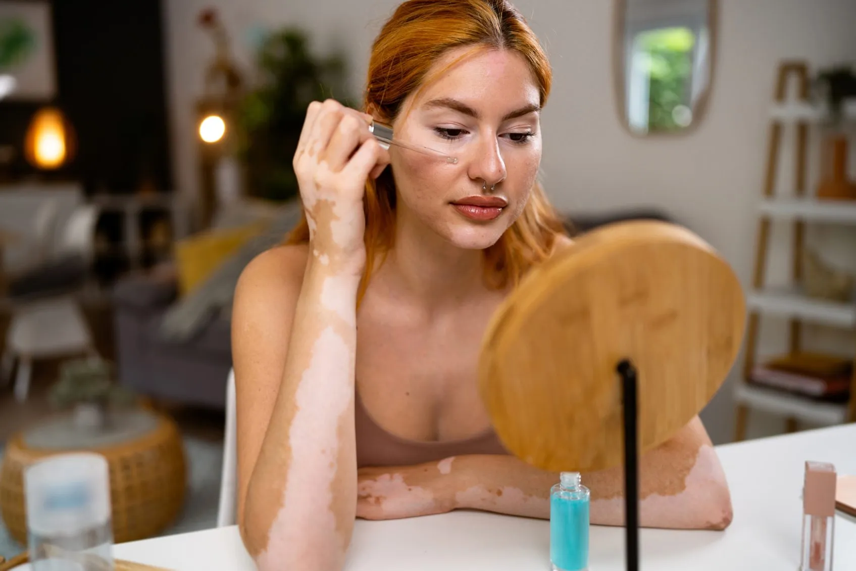 Young redhead Caucasian woman, with vitiligo and acne on her face, doing a skin care in her home (Photo by Nadija Pavlovic/Getty Images)
