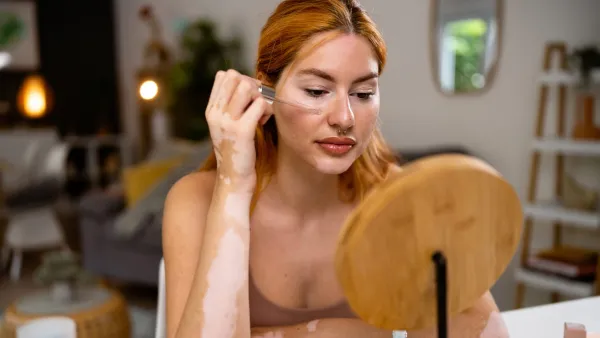Young redhead Caucasian woman, with vitiligo and acne on her face, doing a skin care in her home (Photo by Nadija Pavlovic/Getty Images)