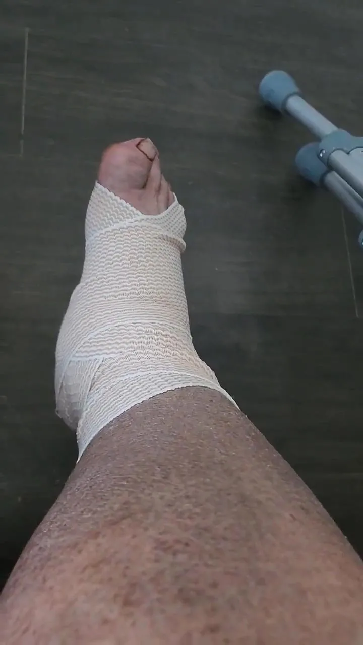 Barstool s Frank the Tank Hospitalized After His Foot Started Shooting Blood 004