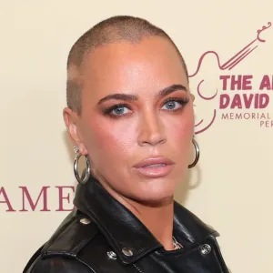 GettyImages-2215493122-Teddi-Mellencamp-Says-Shes-Full-of-Anxiety-Amid-Immunotherapy.jpg