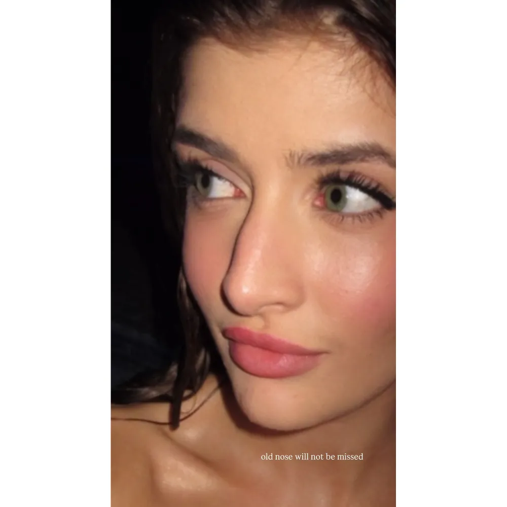 Sami Sheen Reflects on Her Nose Job Results 1 Year Later