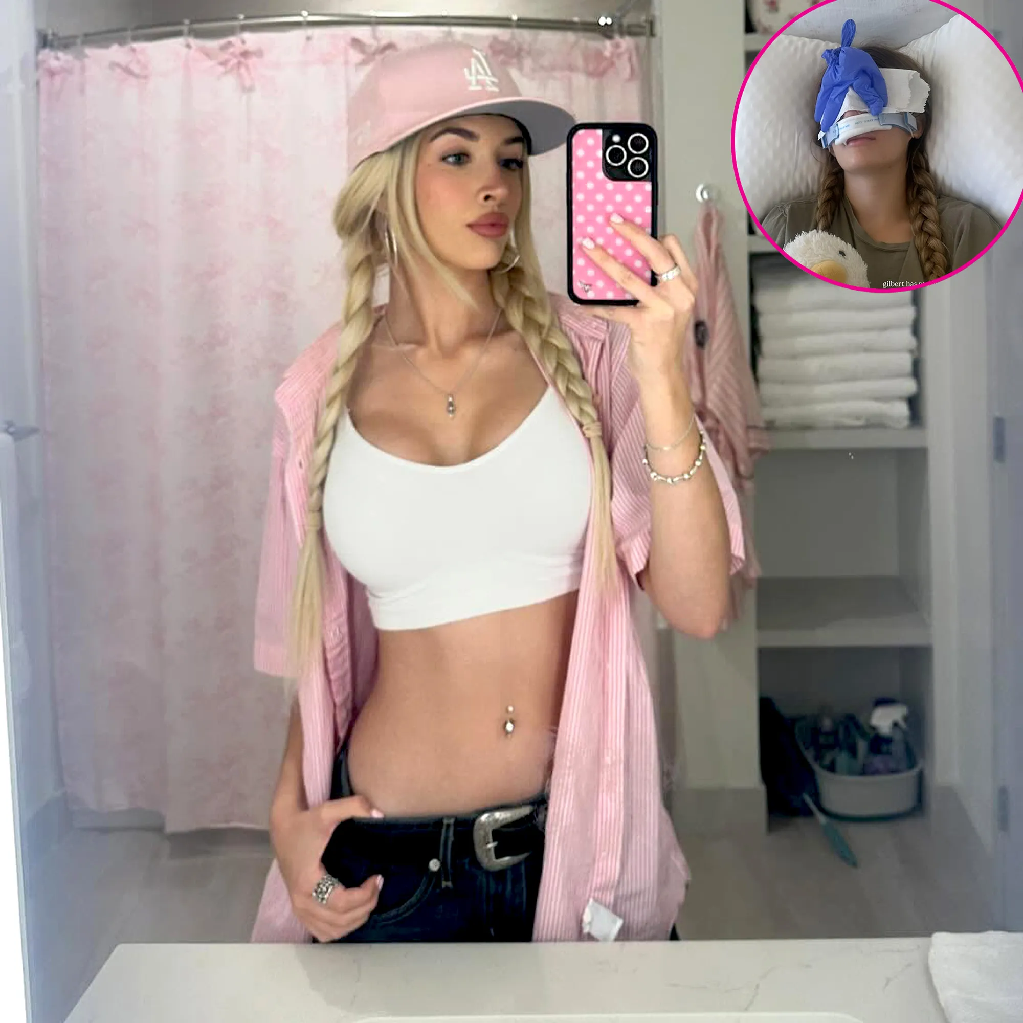 Sami Sheen Reflects on Her Nose Job Results 1 Year Later