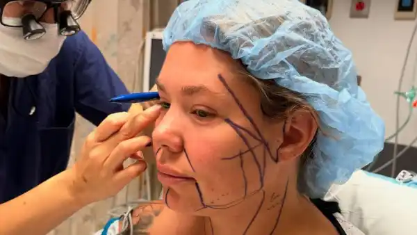Teen Moms Kailyn Lowry Documents the Farewell Tour for the Double Chin Before Surgery