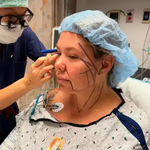 Teen Moms Kailyn Lowry Documents the Farewell Tour for the Double Chin Before Surgery