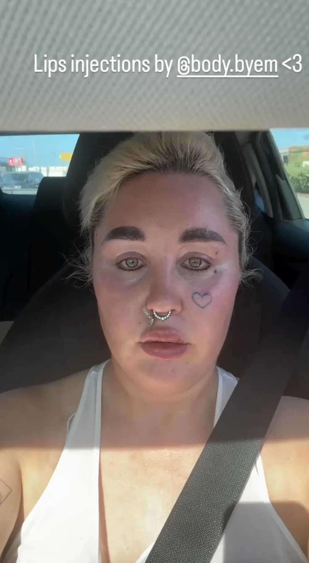 Amanda Bynes Steps Out With Bold Two Toned Hair After Showing Off New Look With Lip Filler