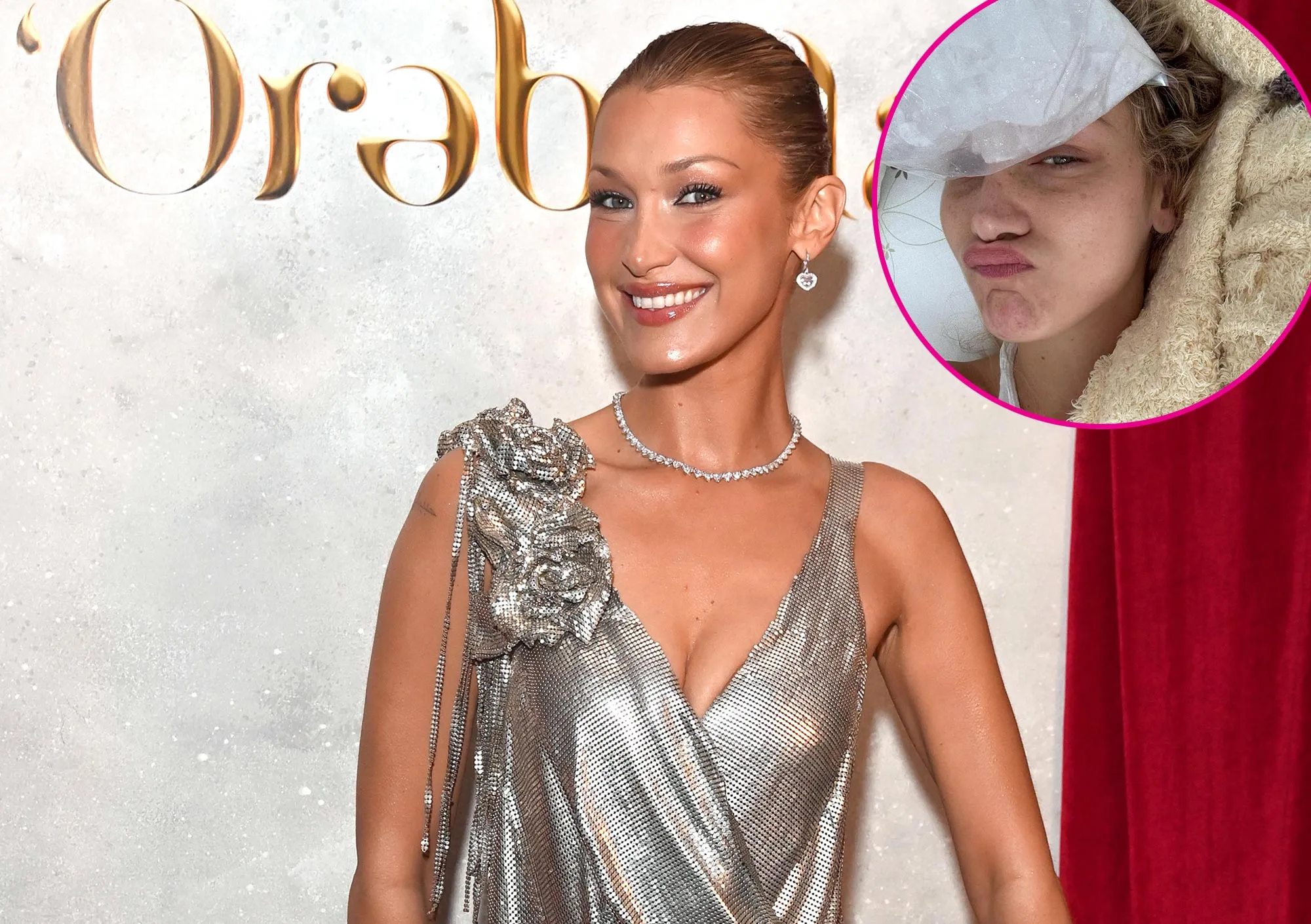 Bella Hadid Explains Being MIA Amid Lyme Disease Battle By Sharing Photos From the Hospital 2215592557