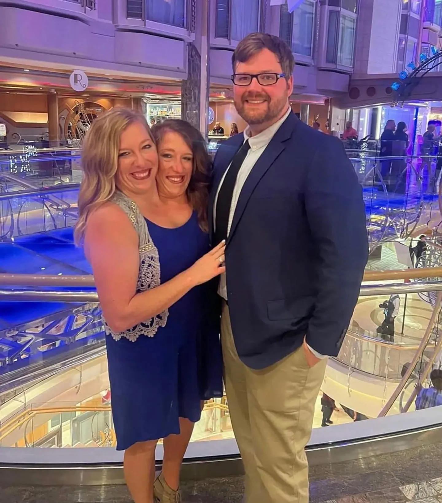 Conjoined Twins TikTok