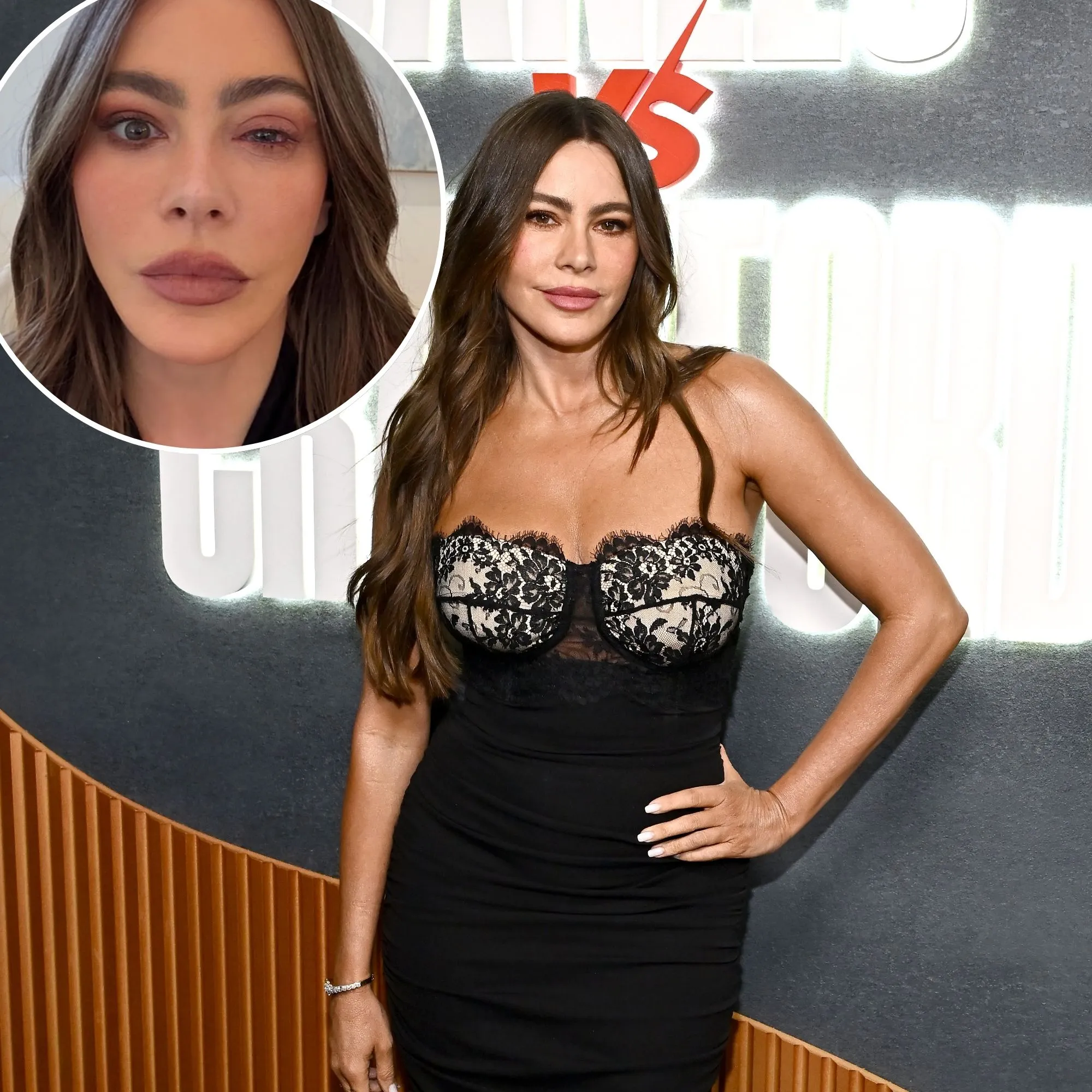 Sofia Vergara Missed the Emmys Due to Eye Allergy