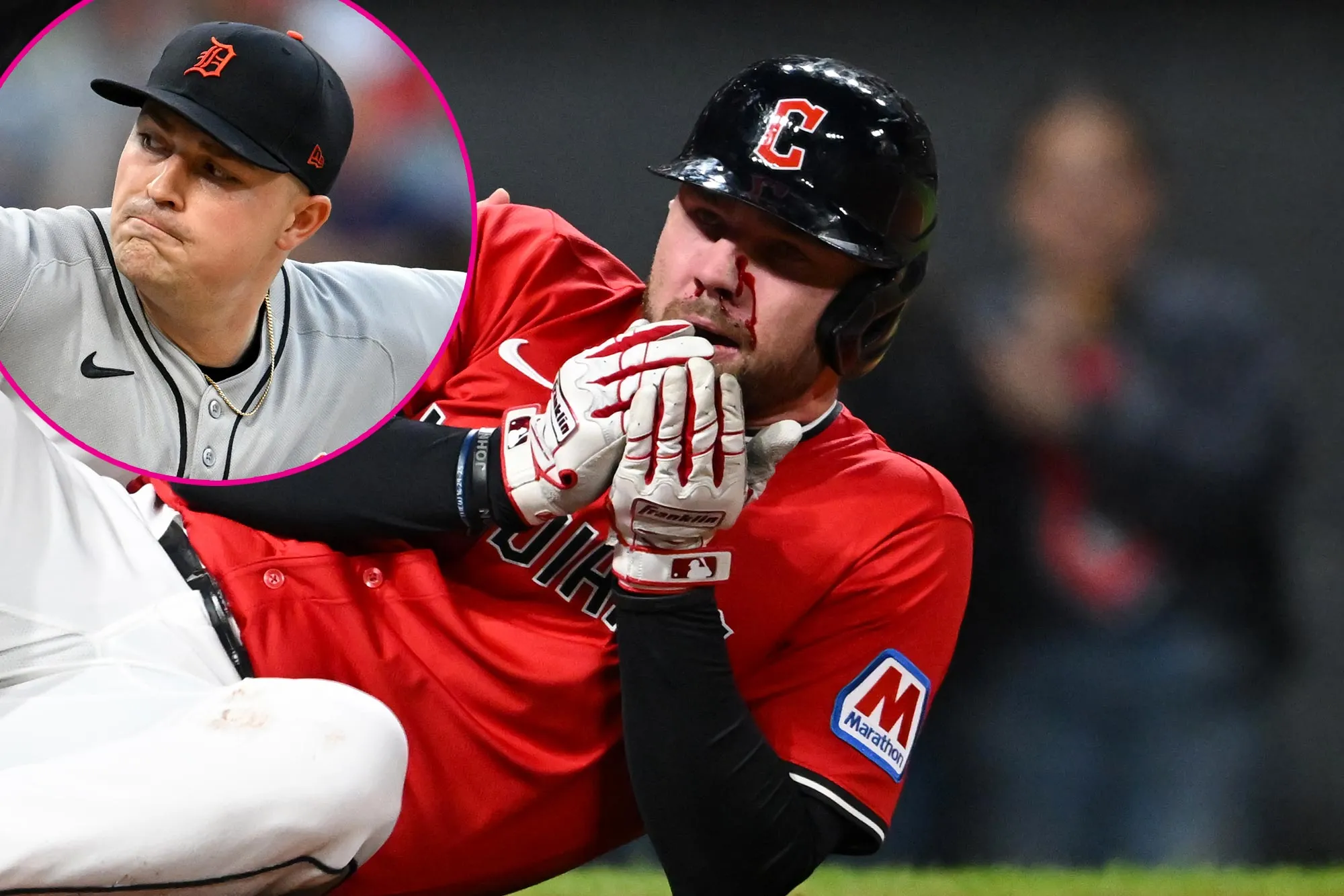 What Tigers Tarik Skubal Texted Guardians David Fry After Fracturing His Face With 99 MPH Fastball GettyImages-2236576742