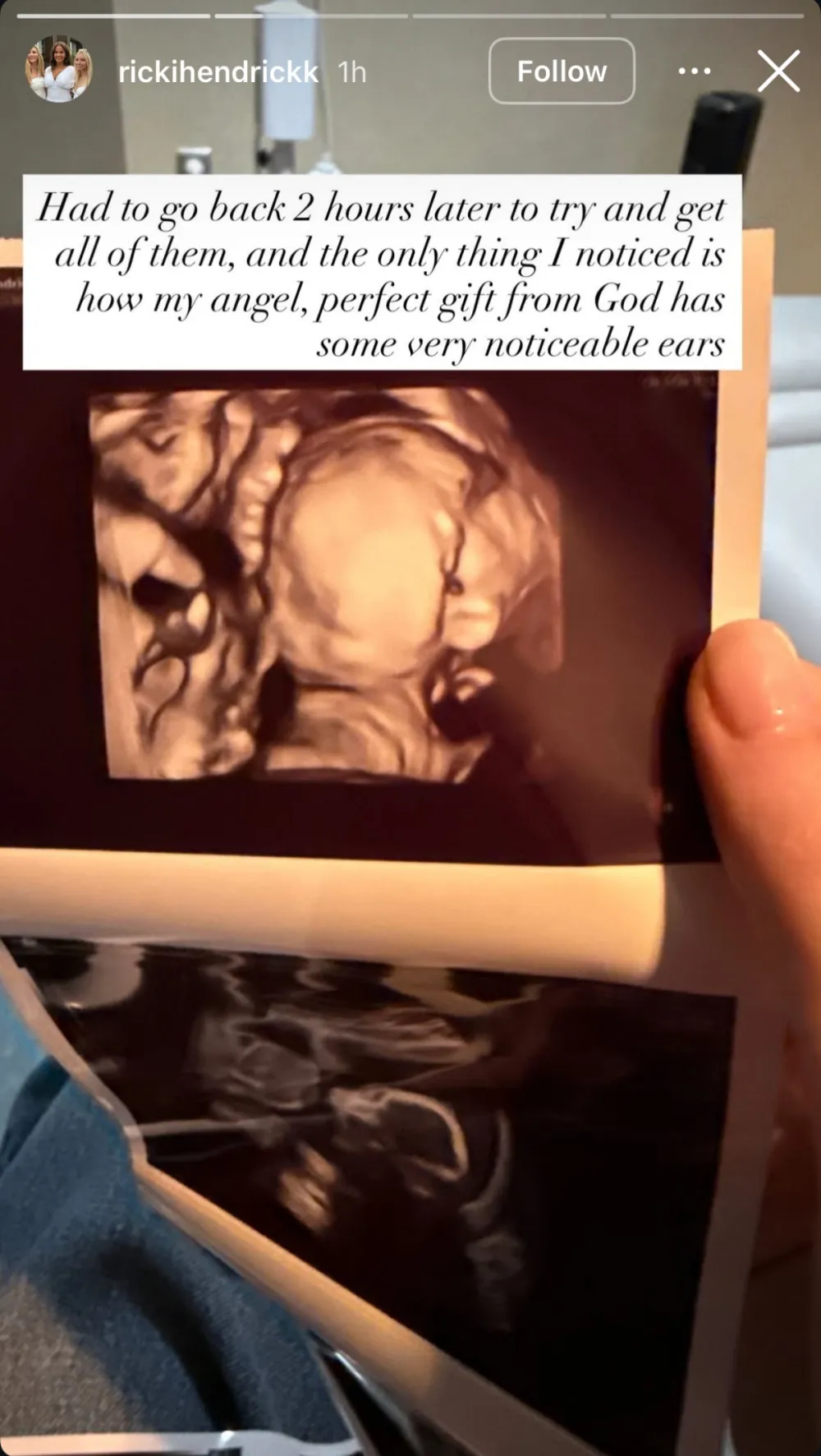 Emily Maynards Pregnant Daughter Ricki Shares Sonogram of Her Baby Girl Perfect Gift