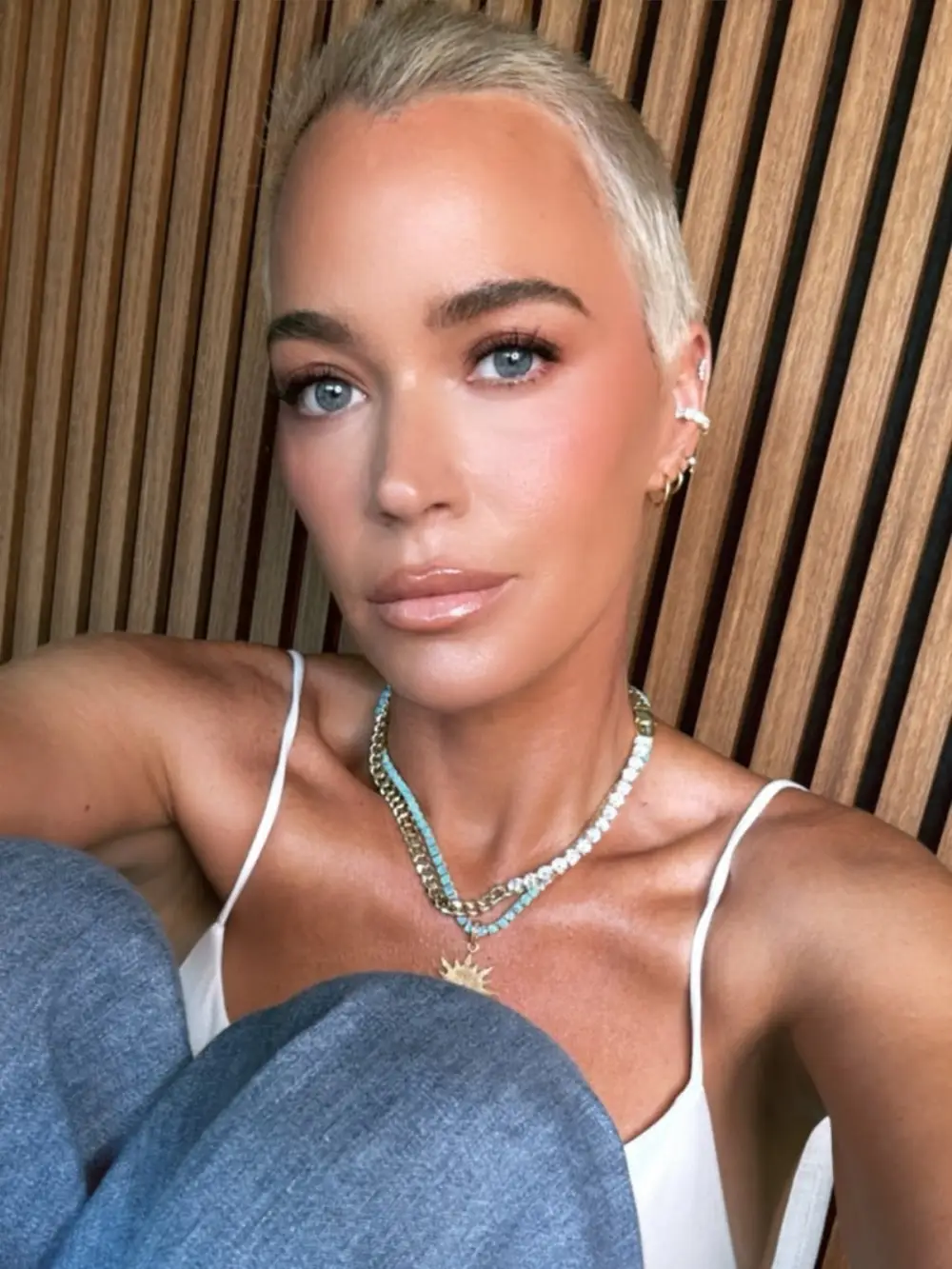 Teddi Mellencamps Health Ups and Downs Skin Cancer Battle, Brain Tumors and More