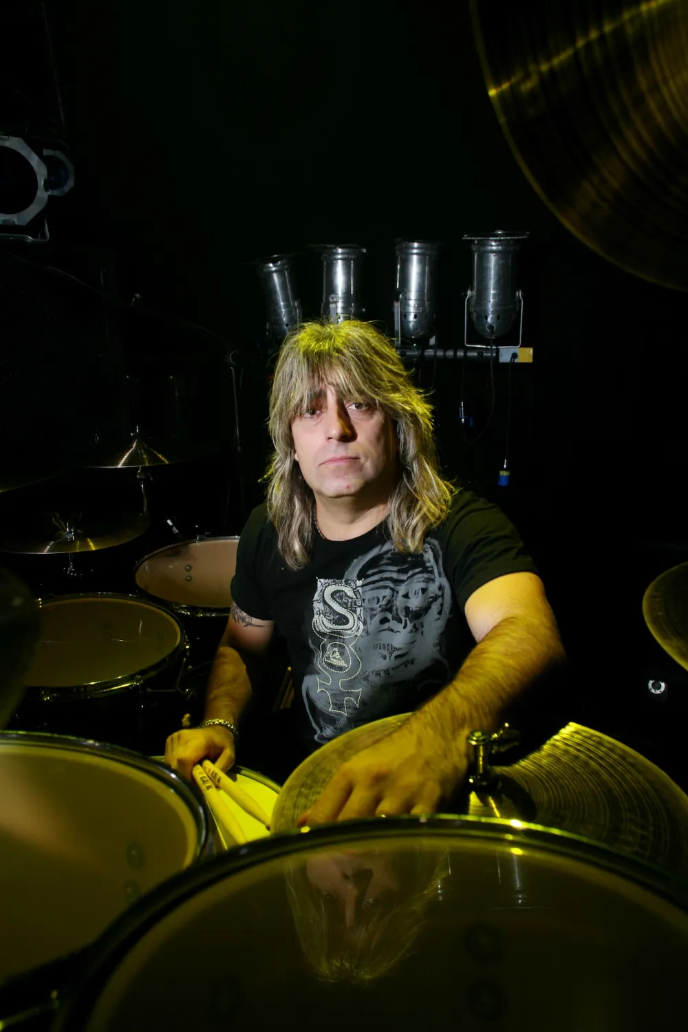 Celebrities Who Have Had Sepsis